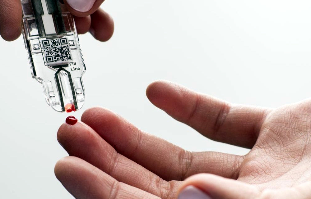 Point-Of-Care Testing